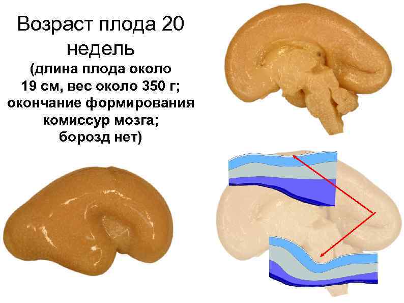 Возраст плода 20 недель (длина плода около 19 см, вес около 350 г; окончание