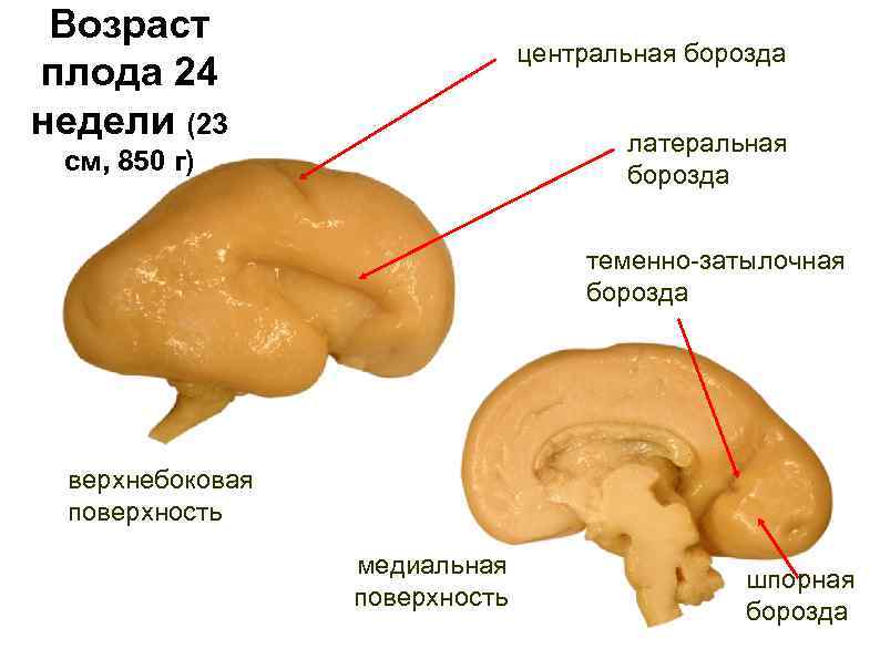 Возраст плода 24 недели (23 центральная борозда латеральная борозда см, 850 г) теменно-затылочная борозда