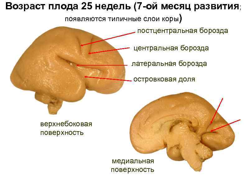 Возраст плода 25 недель (7 -ой месяц развития; появляются типичные слои коры) постцентральная борозда