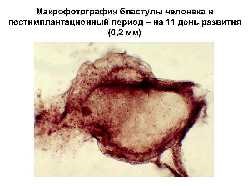 Макрофотография бластулы человека в постимплантационный период – на 11 день развития (0, 2 мм)