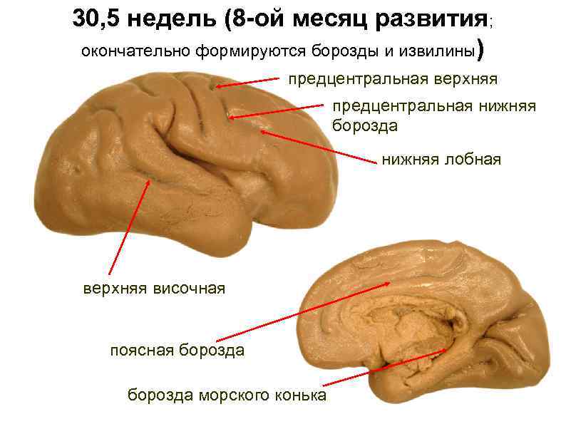 30, 5 недель (8 -ой месяц развития; окончательно формируются борозды и извилины) предцентральная верхняя