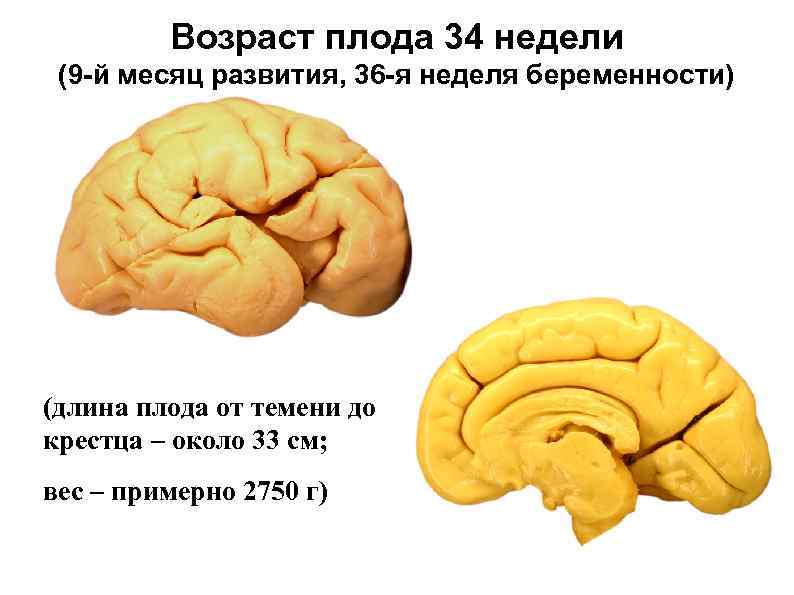 Возраст плода 34 недели (9 -й месяц развития, 36 -я неделя беременности) (длина плода