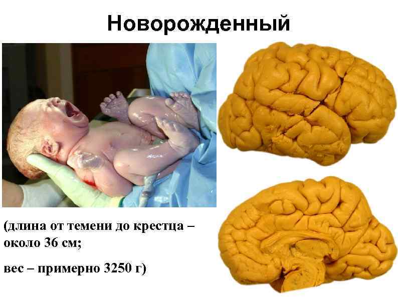 Новорожденный (длина от темени до крестца – около 36 см; вес – примерно 3250
