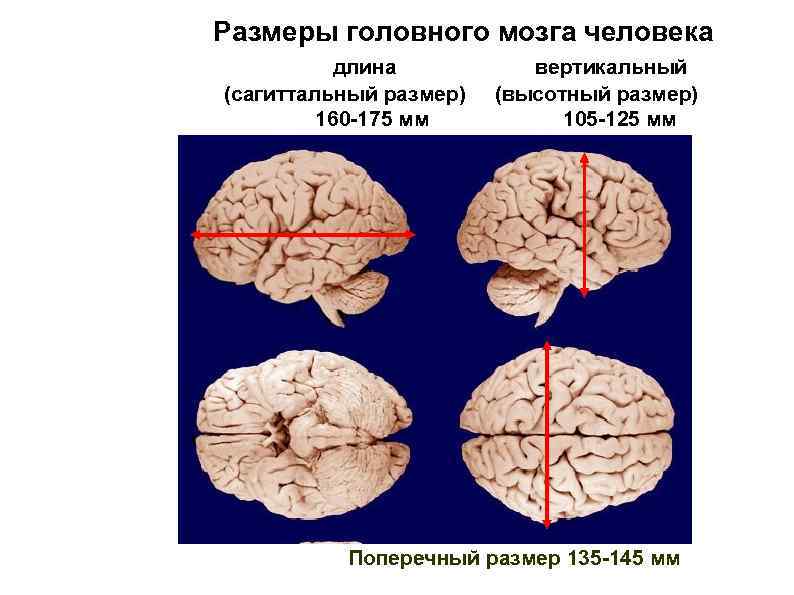 Размеры головного мозга человека длина (сагиттальный размер) 160 -175 мм вертикальный (высотный размер) 105