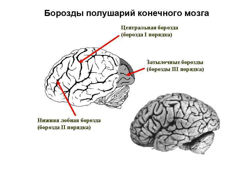 Борозды полушарий конечного мозга Центральная борозда (борозда I порядка) Затылочные борозды (борозды III порядка)
