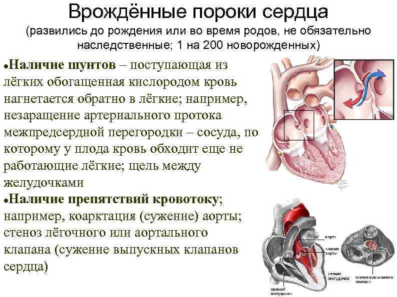 Врождённые пороки сердца (развились до рождения или во время родов, не обязательно наследственные; 1