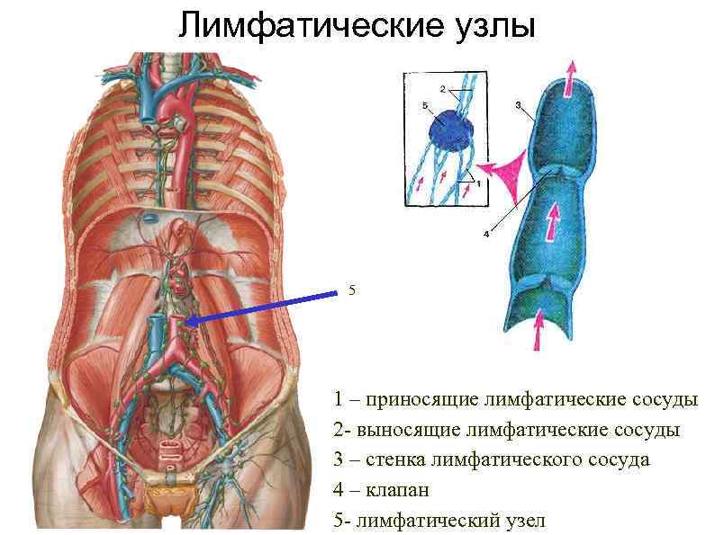 Лимфатические узлы 5 1 – приносящие лимфатические сосуды 2 - выносящие лимфатические сосуды 3