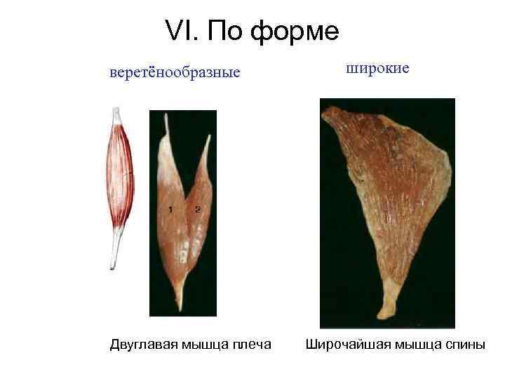 VI. По форме веретёнообразные Двуглавая мышца плеча широкие Широчайшая мышца спины 