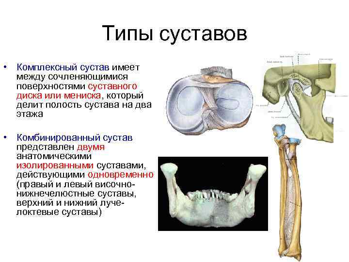 Типы суставов • Комплексный сустав имеет между сочленяющимися поверхностями суставного диска или мениска, который