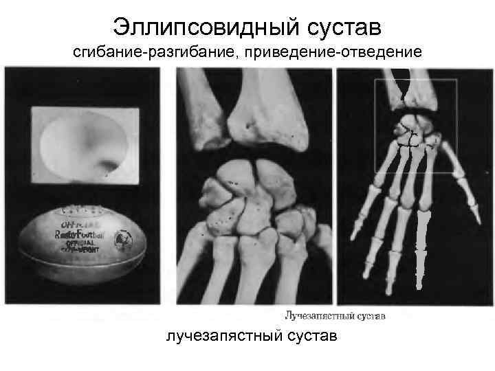 Какой цифрой на схеме строения сустава обозначены связки