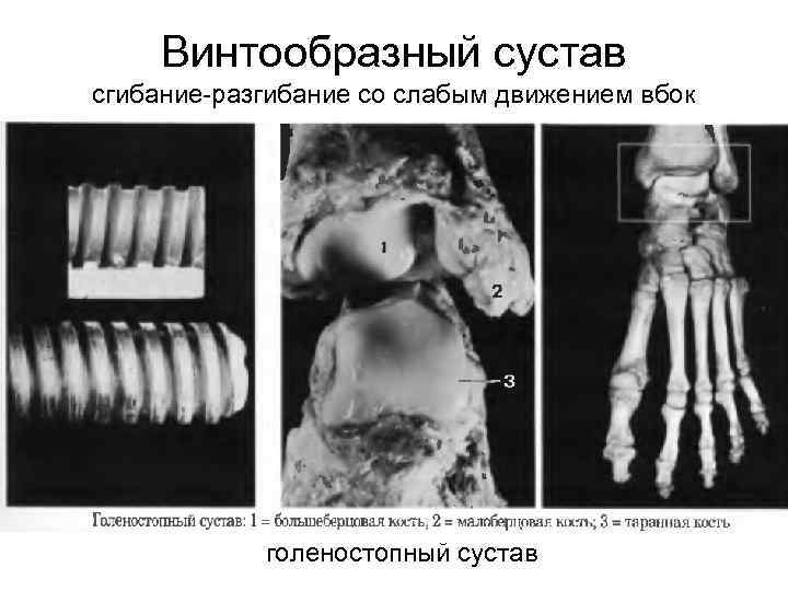 Винтообразный сустав сгибание-разгибание со слабым движением вбок голеностопный сустав 