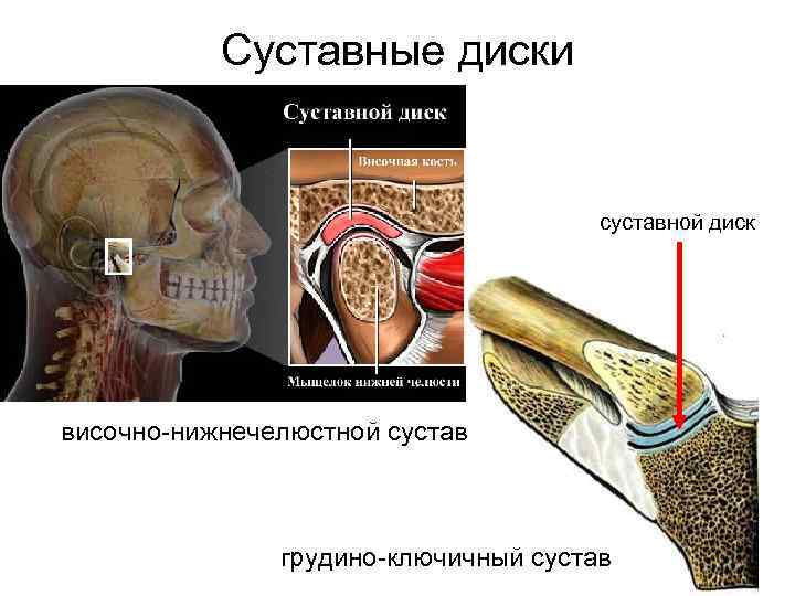 Для диагностики смещения суставного диска височно нижнечелюстного сустава внчс применяют метод