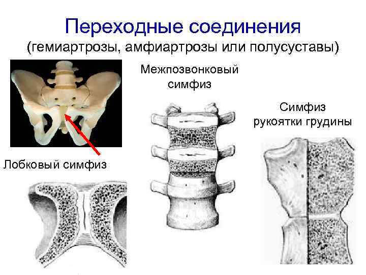 Кости позвоночника тип соединения. Полусуставы соединения костей. Полусуставы симфизы соединение костей. Лобковый симфиз соединение костей. Симфиз рукоятки грудины.