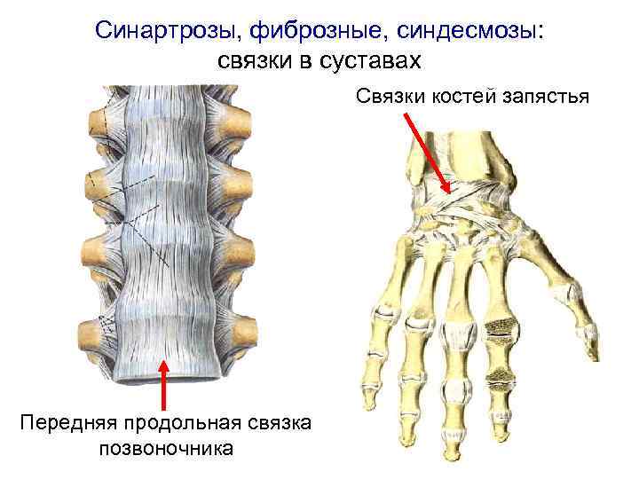 Синартрозы, фиброзные, синдесмозы: связки в суставах Связки костей запястья Передняя продольная связка позвоночника 