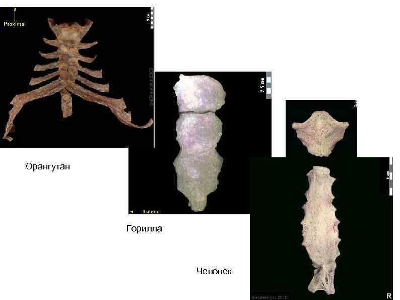 Орангутан Горилла Человек 