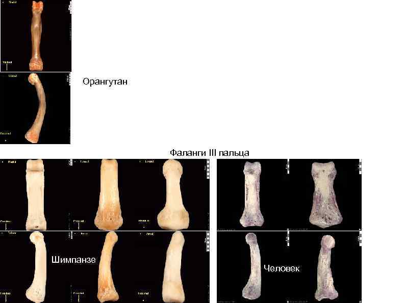 Орангутан Фаланги III пальца Шимпанзе Человек 