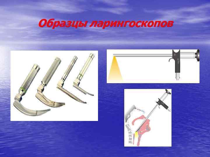 Образцы ларингоскопов 