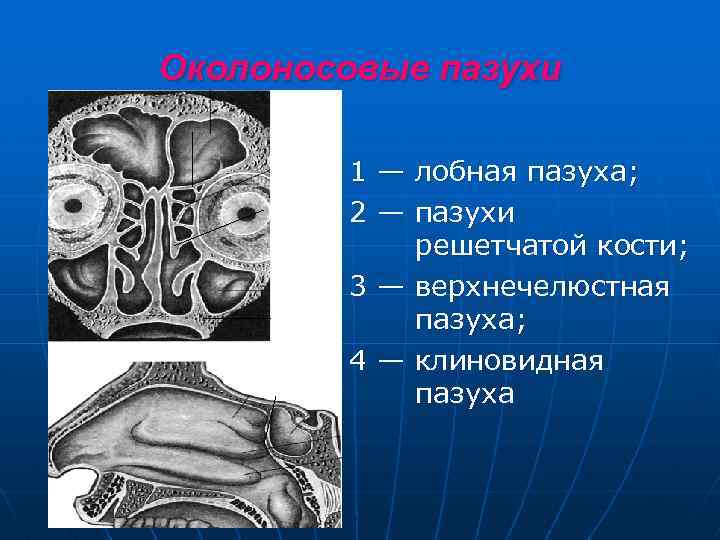 Околоносовые пазухи 1 — лобная пазуха; 2 — пазухи решетчатой кости; 3 — верхнечелюстная