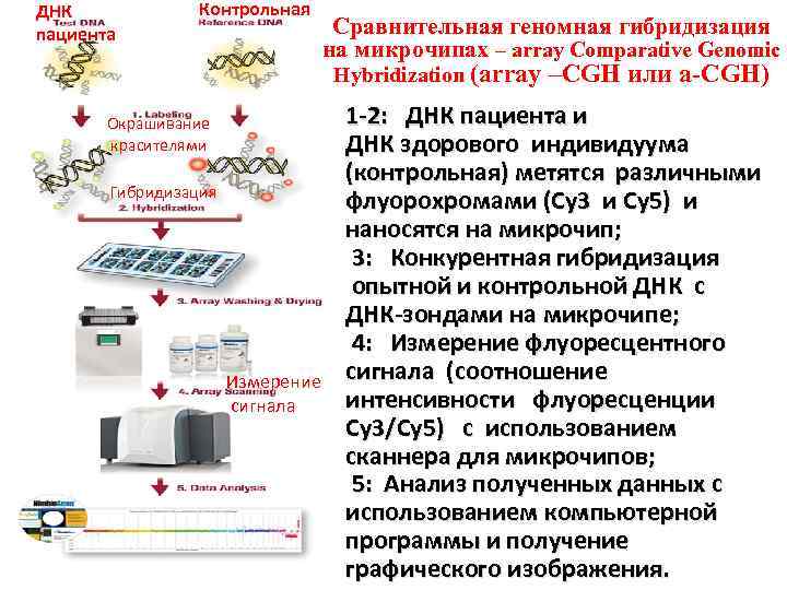 ДНК пациента Контрольная Сравнительная геномная гибридизация на микрочипах – array Comparative Genomic Hybridization (array