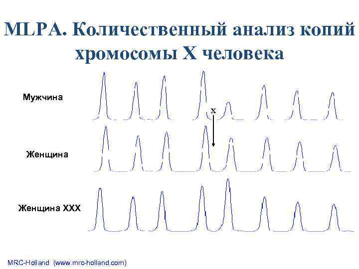 MLPA. Количественный анализ копий хромосомы Х человека Мужчина X Женщина ХХХ MRC-Holland (www. mrc-holland.