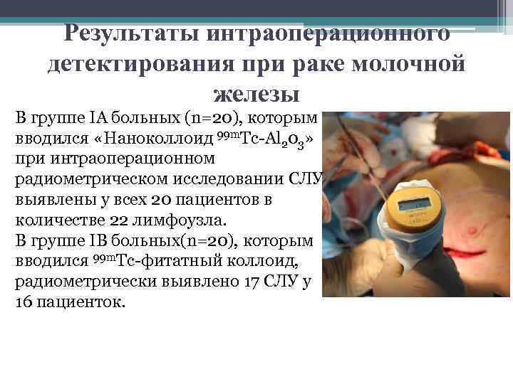 Результаты интраоперационного детектирования при раке молочной железы В группе IA больных (n=20), которым вводился