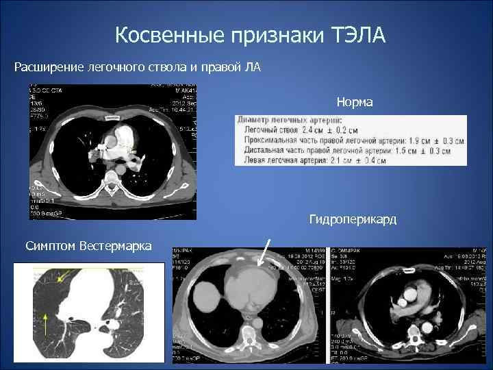 Тэла кт картина