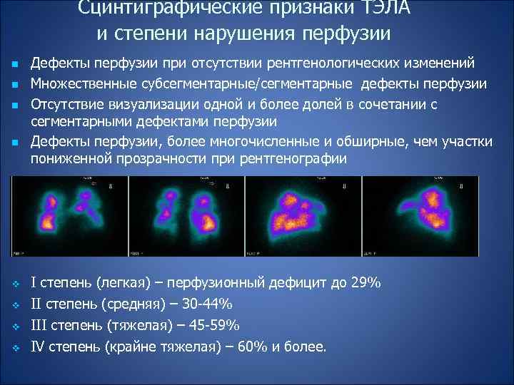 Сцинтиграфические признаки ТЭЛА и степени нарушения перфузии n n v v Дефекты перфузии при