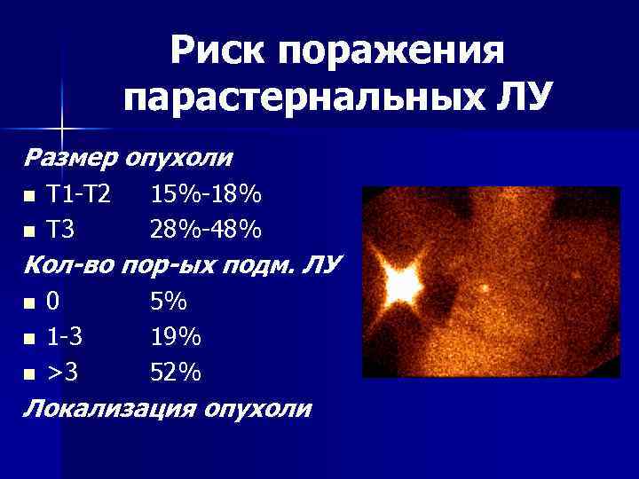 Риск поражения парастернальных ЛУ Размер опухоли n n T 1 -T 2 T 3