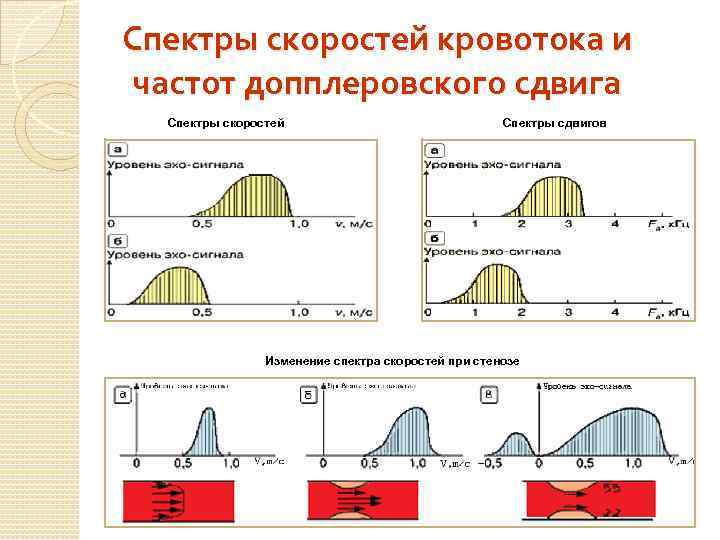 Спектры скоростей кровотока и частот допплеровского сдвига Спектры скоростей Спектры сдвигов Изменение спектра скоростей