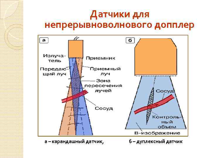 Датчики для непрерывноволнового допплер а – карандашный датчик, б – дуплексный датчик 