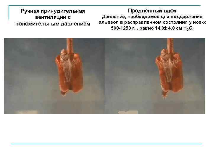 Ручная принудительная вентиляции с положительным давлением Продлённый вдох Давление, необходимое для поддержания альвеол в