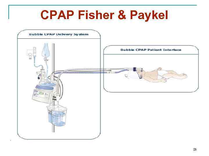 CPAP Fisher & Paykel 25 