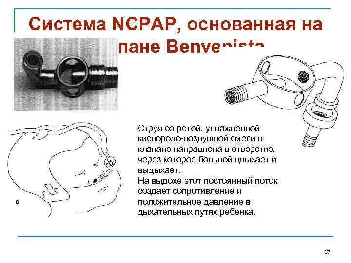 Система NCPAP, основанная на клапане Benvenista Струя согретой, увлажненной кислородо-воздушной смеси в клапане направлена