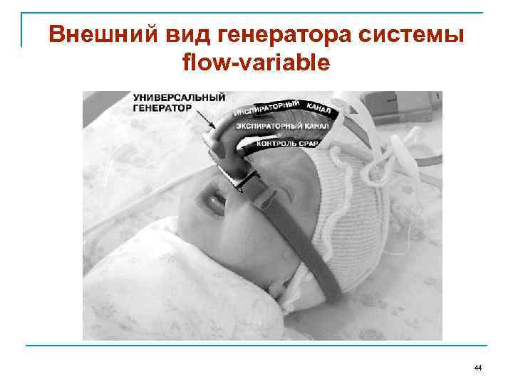 Внешний вид генератора системы flow-variable 44 
