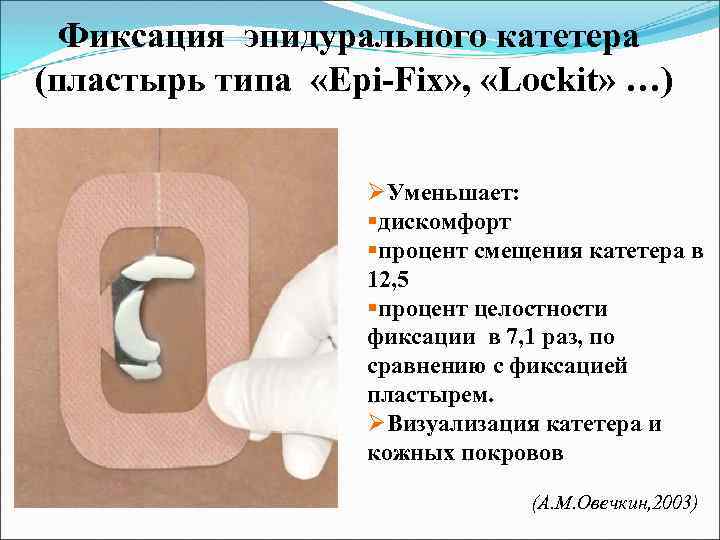 Фиксация эпидурального катетера (пластырь типа «Epi-Fix» , «Lockit» …) ØУменьшает: §дискомфорт §процент смещения катетера