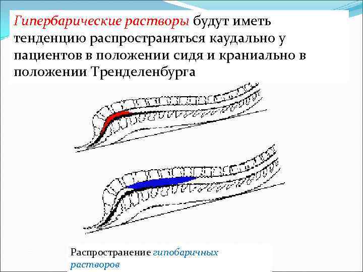 Гипербарические растворы будут иметь тенденцию распространяться каудально у пациентов в положении сидя и краниально