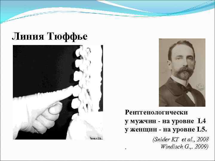 Линия Тюффье Рентгенологически у мужчин - на уровне L 4 у женщин - на