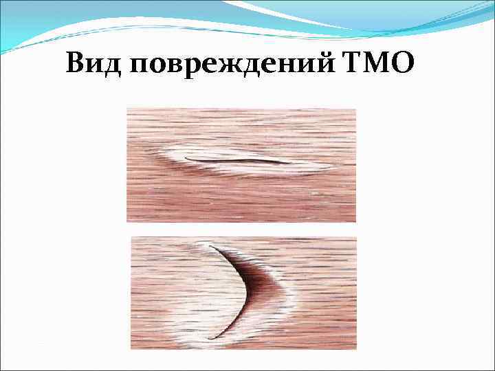 Вид повреждений ТМО 