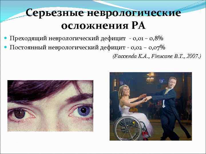 Серьезные неврологические осложнения РА Преходящий неврологический дефицит - 0, 01 – 0, 8% Постоянный