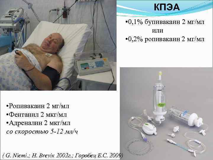 КПЭА • 0, 1% бупивакаин 2 мг/мл или • 0, 2% ропивакаин 2 мг/мл