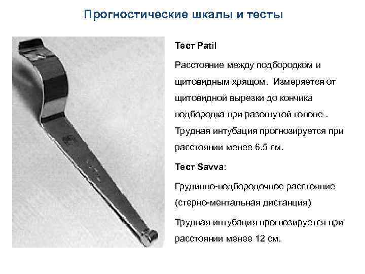 Прогностические шкалы и тесты Тест Patil Расстояние между подбородком и щитовидным хрящом. Измеряется от