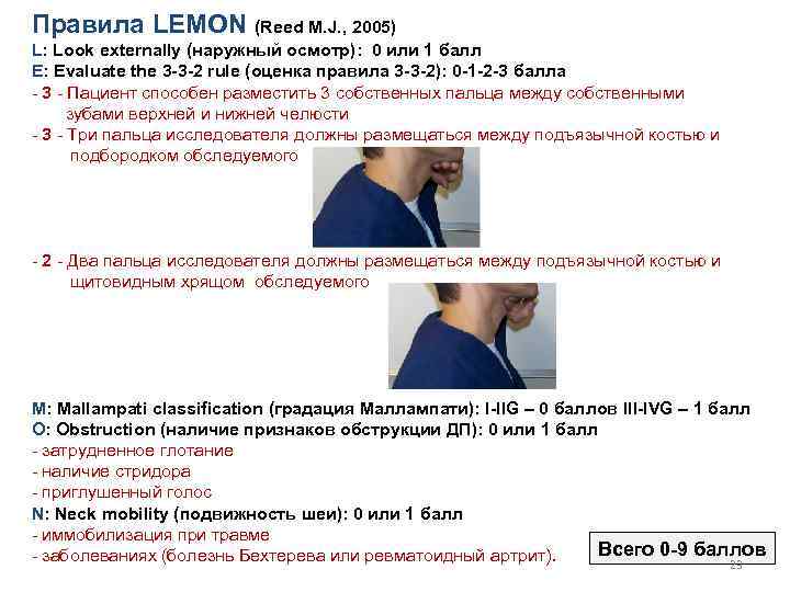 Правила LEMON (Reed M. J. , 2005) L: Look externally (наружный осмотр): 0 или