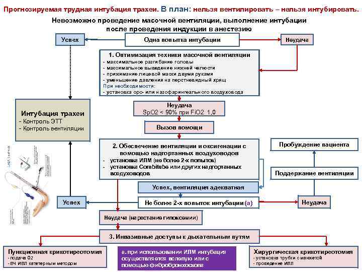 Прогнозируемая трудная интубация трахеи. В план: нельзя вентилировать – нельзя интубировать. Невозможно проведение масочной