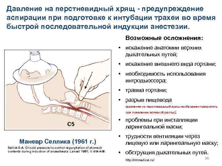 Интубация трахеи презентация