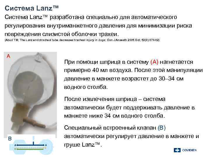 Система Lanz™ разработана специально для автоматического регулирования внутриманжетного давления для минимизации риска повреждения слизистой
