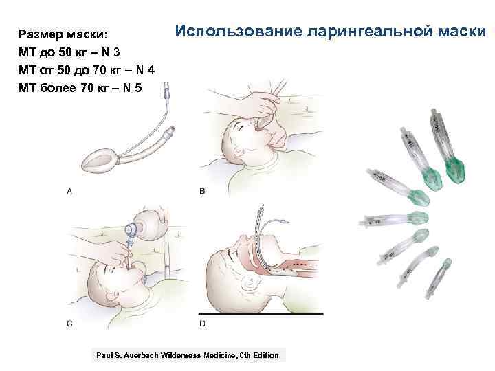 Размер маски: МТ до 50 кг – N 3 МТ от 50 до 70