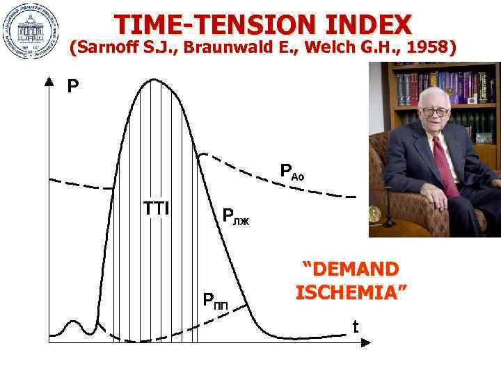 TIME-TENSION INDEX (Sarnoff S. J. , Braunwald E. , Welch G. H. , 1958)