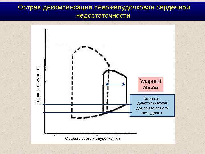 Давление, мм рт. ст. Острая декомпенсация левожелудочковой сердечной недостаточности Ударный объем Конечнодиастолическое давление левого