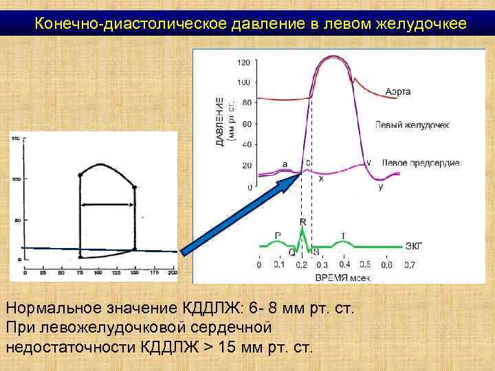 Диастолическое давление левого желудочка