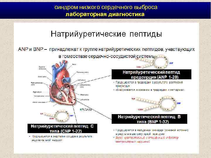  синдром низкого сердечного выброса лабораторная диагностика 